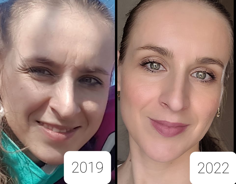 face joga rozdil