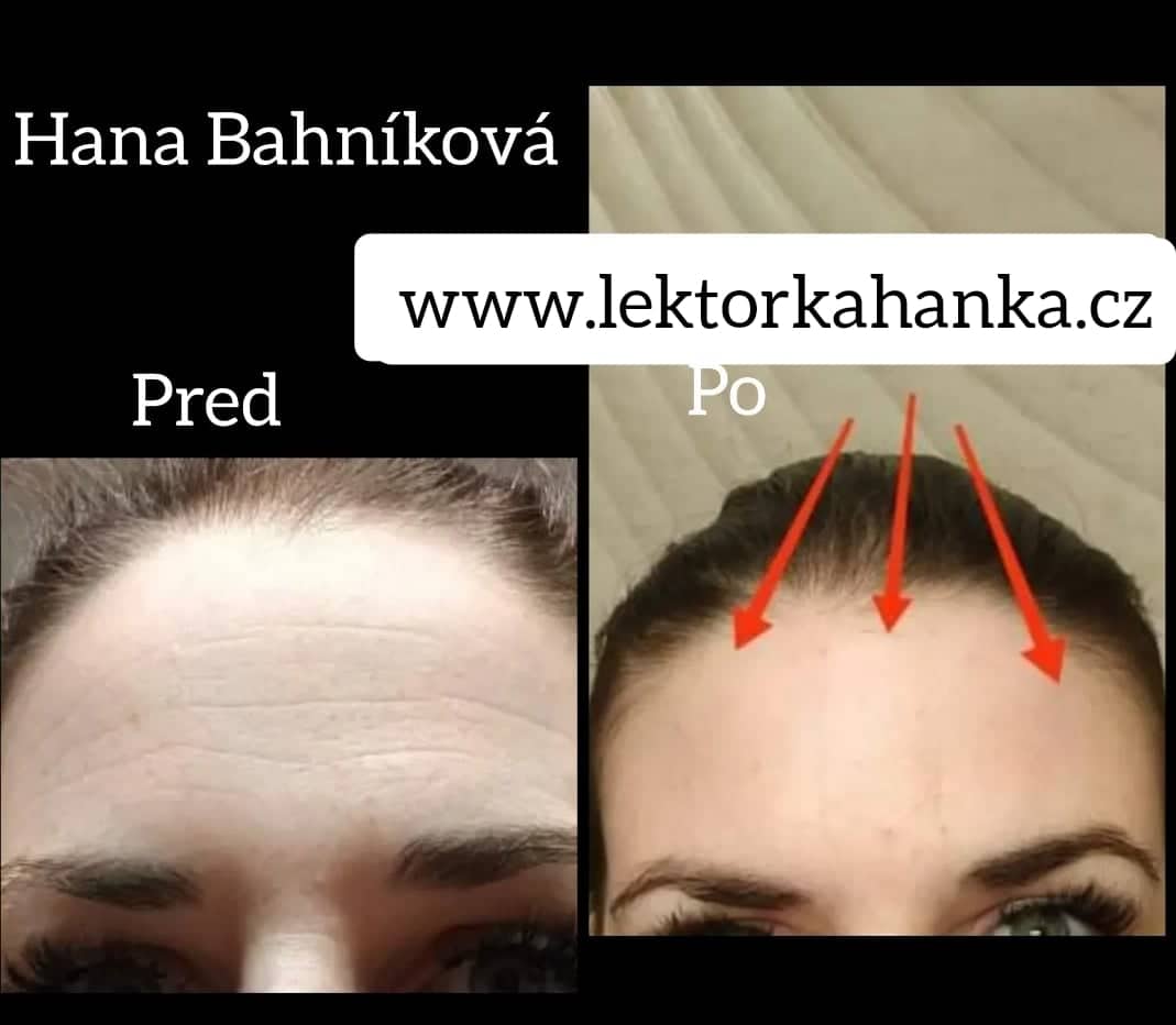 Estetické tejpování změna